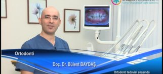 Ortodonti tedavisi sırasında neler yenilebilir?