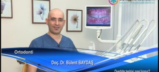 Overbite teşhisi nasıl konur?