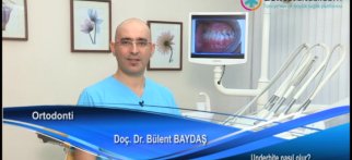 Underbite nasıl olur?