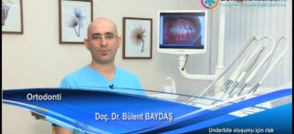 Underbite oluşumu için risk faktörleri nelerdir?