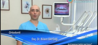 Açık kapanışın teşhisi nasıl konur?