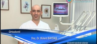 Ortodontik tedavilerde kullanılan lastikler nedir? Ne işe yarar?