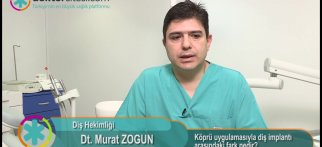 Köprü uygulamasıyla diş implantı arasındaki fark nedir?