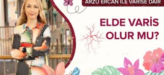 Elde varis olur mu?