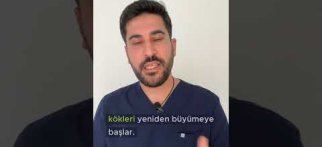 Saç Ekimi Sonuçları Kalıcı mıdır?