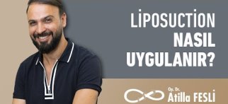 Liposuction Nasıl Uygulanır?