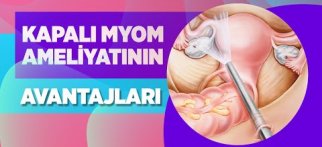 Kapalı Miyom Ameliyatı Nasıl Yapılır? Kapalı Miyom Ameliyatı Riskleri - Doç. Dr. Nermin Köşüş