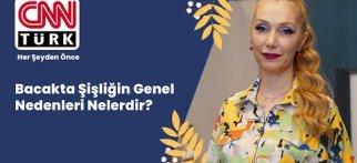 Bacakta Şişliğin Genel Nedenleri Nelerdir?