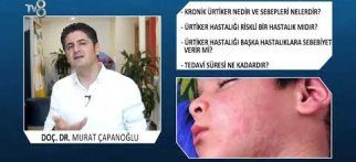 Ürtiker Hastalığı Nedir?