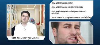 Oral Alerji Sendromu Nedir?