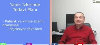 Yanık İzi Tedavisi Ve Yöntemleri
