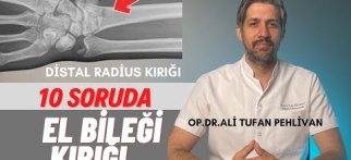 El Bileği Kırığı Nedir// El Bileği Kırığı Nasıl Tedavi Edilir?