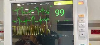 Medical Cardioversion for Hemodynamically stable baby with Supraventricular Tachycardia