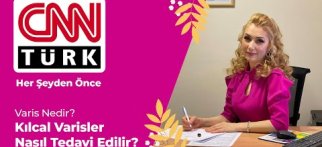 Varis Nedir? Kılcal Varisler Nasıl Tedavi Edilir?