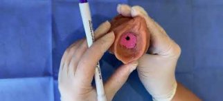 Kızlık Zarı Nedir ? Ne İşe Yarar ? - Doktor İrem Yengel