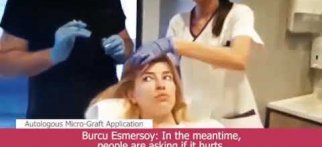 Burcu Esmersoy'un Saçlarına Uyguladığımız Vitamin Takviyesi #MedikalEstetik #SaçTedavileri