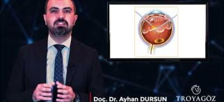 Doç. Dr. Ayhan DURSUN Diyanetik Diyabetik Retinopati Nedir ?
