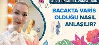 Bacakta varis olduğu nasıl anlaşılır?