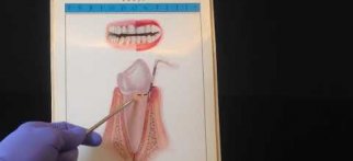 Dişeti Sağlığı, Diş Taşı Nasıl ve Neden Oluşur / AYKAÇDİŞ İmplant Ortodonti Estetik