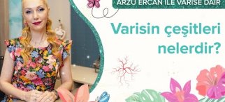 Varisin Çeşitleri Nelerdir?