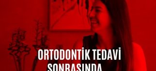 DİŞ TELİ TEDAVİSİNE SON! ŞEFFAF PLAKLARLA ORTODONTİK TEDAVİ NEDİR?