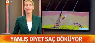 Yanlış Diyetler Saç Döküyor